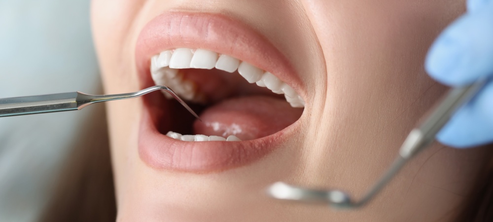 Estetica dentale a Padova